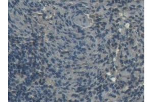 Immunohistochemistry (IHC) image for anti-Fatty Acid Binding Protein 3, Muscle and Heart (FABP3) (AA 2-133) antibody (ABIN7433318)
