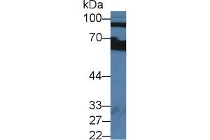 Western blot analysis of Human Serum, using Human CFB Antibody (2 µg/ml) and HRP-conjugated Goat Anti-Rabbit antibody ( (Complement Factor B Antikörper  (AA 35-160))