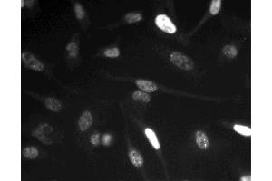 Immunofluorescent staining of HeLa (ATCC CCL-2) cells. (Cyclin E1 Antikörper)