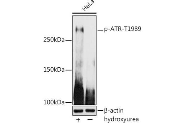 ATR Antikörper  (pThr1989)