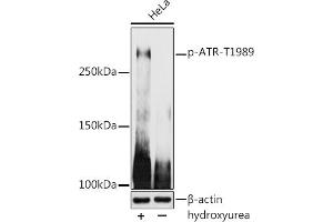 Western blot analysis of extracts of HeLa cells, using Phospho-ATR-T1989 antibody (ABIN7265777) at 1:1000 dilution. (ATR Antikörper  (pThr1989))