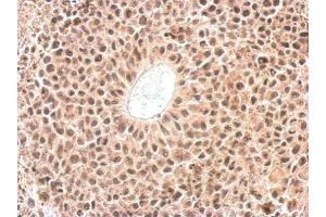 IHC-P Image Cyclophilin E antibody detects PPIE protein at nucleus on HeLa xenograft by immunohistochemical analysis. (PPIE Antikörper)
