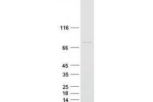 Validation with Western Blot