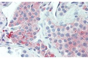 Immunohistochemistry (IHC) image for anti-Urocortin 2 (UCN2) (AA 20-112) antibody (ABIN7435022)