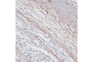 Immunohistochemistry (IHC) image for anti-Tropomyosin 1 (Alpha) (TPM1) (AA 1-245) antibody (ABIN3021578)