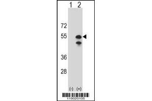Western blot analysis of CPN1 using rabbit polyclonal CPN1 Antibody using 293 cell lysates (2 ug/lane) either nontransfected (Lane 1) or transiently transfected (Lane 2) with the CPN1 gene.
