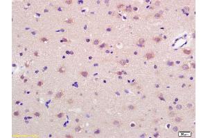 Formalin-fixed and paraffin embedded rat brain labeled with Anti-GRP75 Polyclonal Antibody, Unconjugated (ABIN686992) at 1:200 followed by conjugation to the secondary antibody and DAB staining.