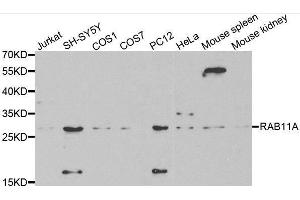 Western blot analysis of extracts of various cell lines, using RAB11A antibody. (RAB11A Antikörper  (AA 1-216))
