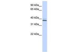 Image no. 1 for anti-ERGIC and Golgi 2 (ERGIC2) (C-Term) antibody (ABIN6740585) (ERGIC2 Antikörper  (C-Term))