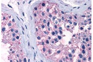 Immunohistochemistry (Formalin/PFA-fixed paraffin-embedded sections) of human testis tissue with TAS1R1 polyclonal antibody .
