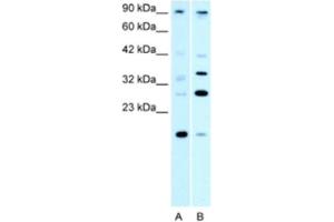 Western Blotting (WB) image for anti-Poly (ADP-Ribose) Polymerase Family, Member 11 (PARP11) antibody (ABIN2460805) (PARP11 Antikörper)