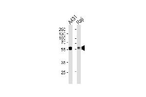 Western blot analysis of lysates from A431, Raji cell line (from left to right), using LYN Antibody (ABIN1944840 and ABIN2843643).