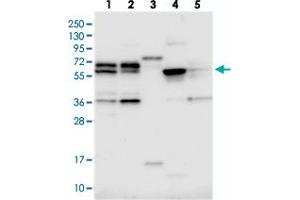 Western blot analysis of Lane 1: RT-4, Lane 2: U-251 MG, Lane 3: Human Plasma, Lane 4: Liver, Lane 5: Tonsil with C15orf52 polyclonal antibody  at 1:250-1:500 dilution. (C15ORF52 Antikörper)
