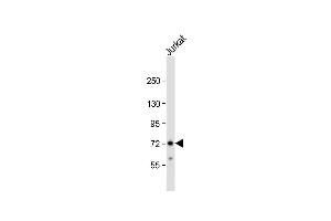 Anti-ZFP36 Antibody (Center) at 1:1000 dilution + Jurkat whole cell lysate Lysates/proteins at 20 μg per lane. (ZFP36 Antikörper  (AA 119-148))