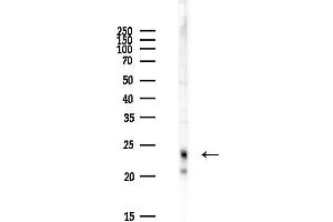 anti-Chromosome 16 Open Reading Frame 80 (C16orf80) antibody