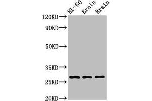 Western Blot Positive WB detected in: Rat brain tissue, Mouse brain tissue All lanes: EMX2 antibody at 2. (EMX2 Antikörper  (AA 75-141))