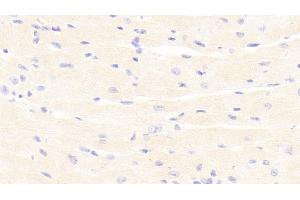 Detection of PDGF BB in Mouse Cardiac Muscle Tissue using Polyclonal Antibody to Platelet Derived Growth Factor BB (PDGF BB) (PDGF-BB Homodimer (AA 21-241) Antikörper)
