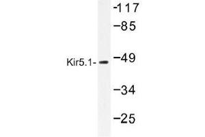 Image no. 1 for anti-Potassium Inwardly-Rectifying Channel, Subfamily J, Member 16 (KCNJ16) antibody (ABIN317797) (KIR5.1 Antikörper)
