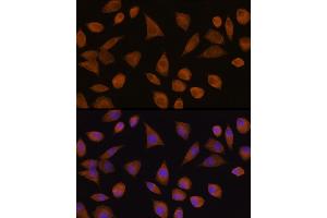Immunofluorescence analysis of L929 cells using CRYZ Rabbit pAb  at dilution of 1:100 (40x lens).