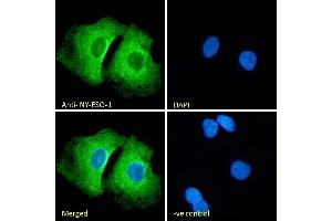(ABIN570720) Immunofluorescence analysis of paraformaldehyde fixed A549 cells, permeabilized with 0. (CTAG1B Antikörper  (Internal Region))