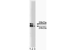 Western blot analysis of COMT on a rat pituitary lysate.