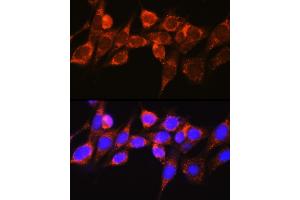 Immunofluorescence analysis of NIH-3T3 cells using Raf1 Rabbit pAb (ABIN3020712, ABIN3020713, ABIN3020714 and ABIN6213686) at dilution of 1:100 (40x lens).
