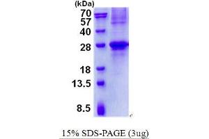 Image no. 1 for Germinal Center Expressed Transcript 2 (GCET2) protein (His tag) (ABIN1098460)