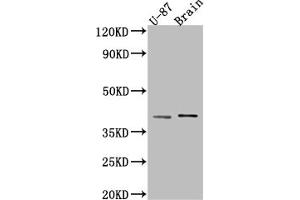 Western Blot Positive WB detected in: U-87 whole cell lysate, Rat Brain whole cell lysate All lanes: NGF antibody at 1:1000 Secondary Goat polyclonal to rabbit IgG at 1/50000 dilution Predicted band size: 27 kDa Observed band size: 39 kDa (Rekombinanter Nerve Growth Factor Antikörper)