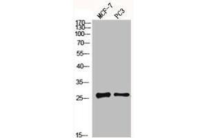 Western Blot analysis of MCF7 PC3 cells using MGMT Polyclonal Antibody (MGMT Antikörper  (N-Term))
