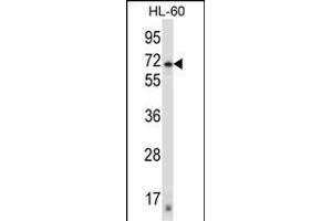 ZN Antibody (N-term) (ABIN657428 and ABIN2846462) western blot analysis in HL-60 cell line lysates (35 μg/lane).