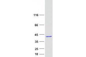 Validation with Western Blot