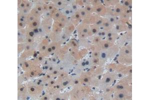#VALUE! (Leucine Rich Repeats And Death Domain Containing Protein (AA 694-885) Antikörper)