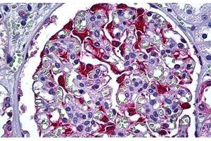 Human Kidney, Glomerulus: Formalin-Fixed, Paraffin-Embedded (FFPE)