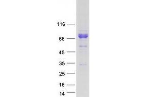 Validation with Western Blot