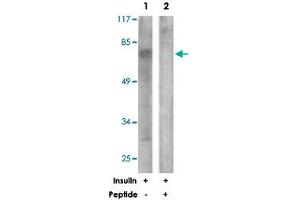 Western blot analysis of extracts from NIH/3T3 cells, treated with Insulin (0. (GRB10 Antikörper)