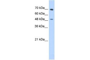 WB Suggested Anti-ZNF821 Antibody Titration:  0. (ZNF821 Antikörper  (C-Term))