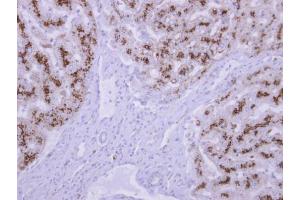IHC-P Image TPP1 antibody detects TPP1 protein at cytosol on human normal liver by immunohistochemical analysis. (TPP1 Antikörper)