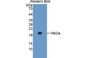 Western blot analysis of the recombinant protein. (PLA2G10 Antikörper  (AA 32-165))