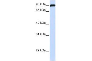 FAM62C antibody used at 1 ug/ml to detect target protein. (ESYT3 Antikörper)