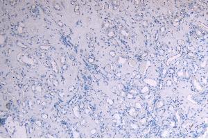 ABIN190759 Negative Control showing staining of paraffin embedded Human Kidney, with no primary antibody.