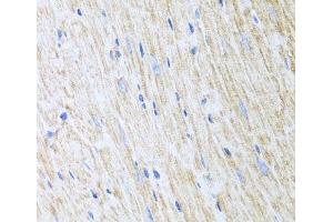 Immunohistochemistry of paraffin-embedded Mouse heart using RCN2 Polyclonal Antibody at dilution of 1:100 (40x lens).