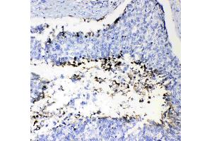 IHC analysis of Prothrombin  using anti-Prothrombin  antibody . (Prothrombin Antikörper  (AA 67-124))