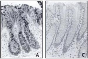 Immunohistochemistry image of mucins in paraffn sections of human embryonic and adult colon mucosa. (alpha 3/4-Monofucosylated Polylactosaminoglycans Antikörper)