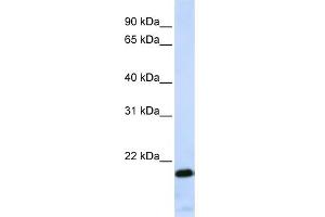 WB Suggested Anti-ZNF428 Antibody Titration:  0. (ZNF428 Antikörper  (Middle Region))