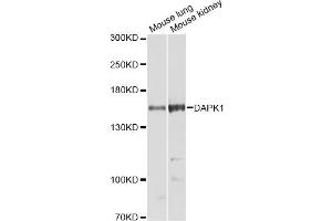 Western blot analysis of extracts of various cell lines, using DAPK1 Antibody (ABIN5973367) at 1/1000 dilution. (DAP Kinase 1 Antikörper)