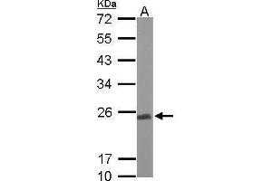 Western Blotting (WB) image for anti-Ubiquinol-Cytochrome C Reductase, Rieske Iron-Sulfur Polypeptide 1 (UQCRFS1) antibody (ABIN2855300)
