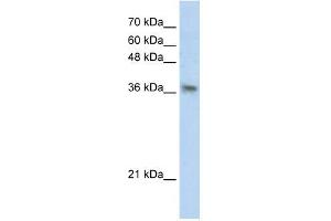 Transfected 293T; WB Suggested Anti-PHYHIP Antibody Titration: 0. (PHYHIP Antikörper  (N-Term))