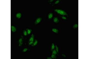 Immunofluorescent analysis of Hela cells using ABIN7148911 at dilution of 1:100 and Alexa Fluor 488-congugated AffiniPure Goat Anti-Rabbit IgG(H+L) (CDKN1C Antikörper  (AA 221-310))