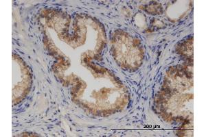 Immunoperoxidase of monoclonal antibody to CYP7B1 on formalin-fixed paraffin-embedded human prostate. (CYP7B1 Antikörper  (AA 203-286))
