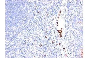 Formalin-fixed, paraffin-embedded human tonsil stained with MYDAM antibody (MYADM/971). (MYADM Antikörper)
